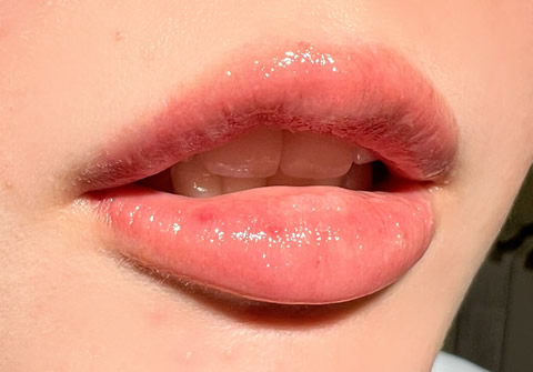 唇と歯のバランス