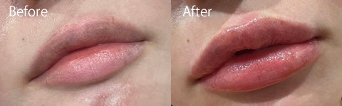 リップアートビフォーアフター