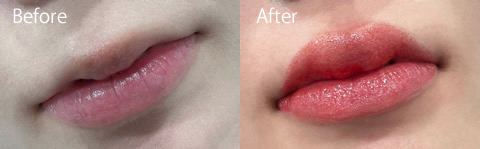 リップアートビフォーアフター