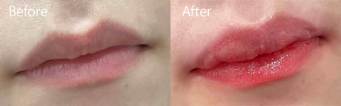 リップアートビフォーアフター