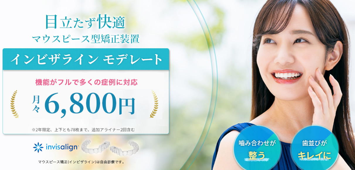 インビザラインモデレート特設ページ