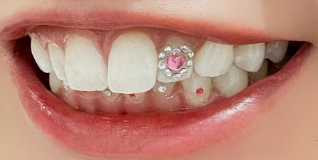 ティースジュエリー