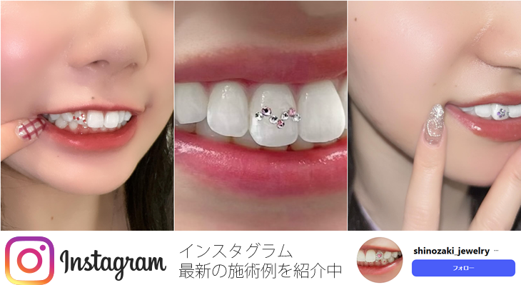 ティースジュエリー